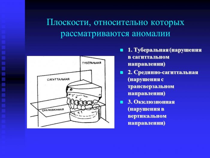 Презентация: Особенности клиники , лечения и профилактики сагиттальных аномалий прикуса