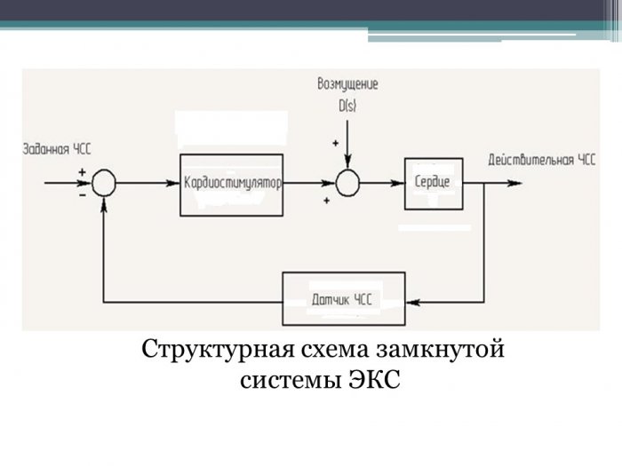 Презентация - Электрокардиостимулятор (ЭКС)