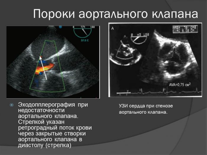 Презентация - «Альбом сканограмм, рентгенограмм, сонограмм по патологии сердечно-сосудистой системы»