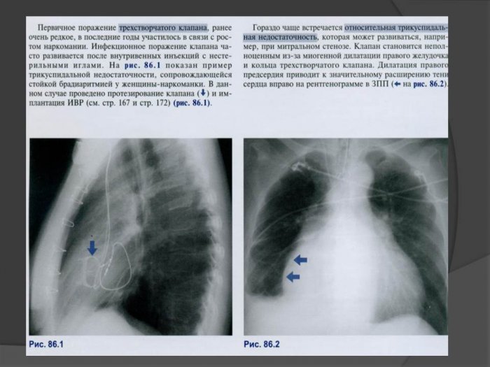 Презентация - «Альбом сканограмм, рентгенограмм, сонограмм по патологии сердечно-сосудистой системы»