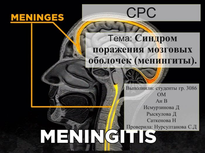 Презентация - Синдром поражения мозговых оболочек (менингиты)