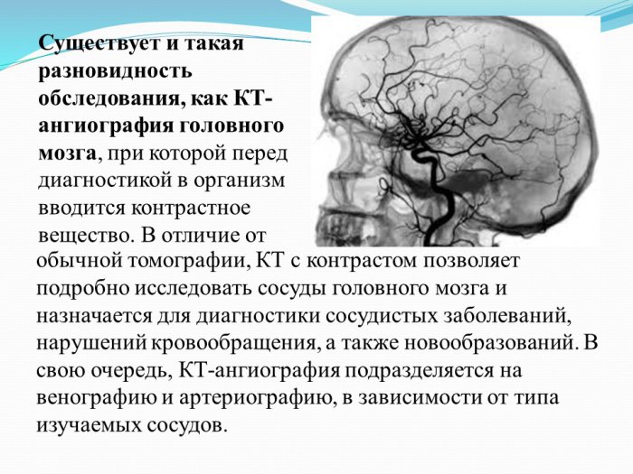 Презентация - Роль КТ в диагностике травмы головного мозга