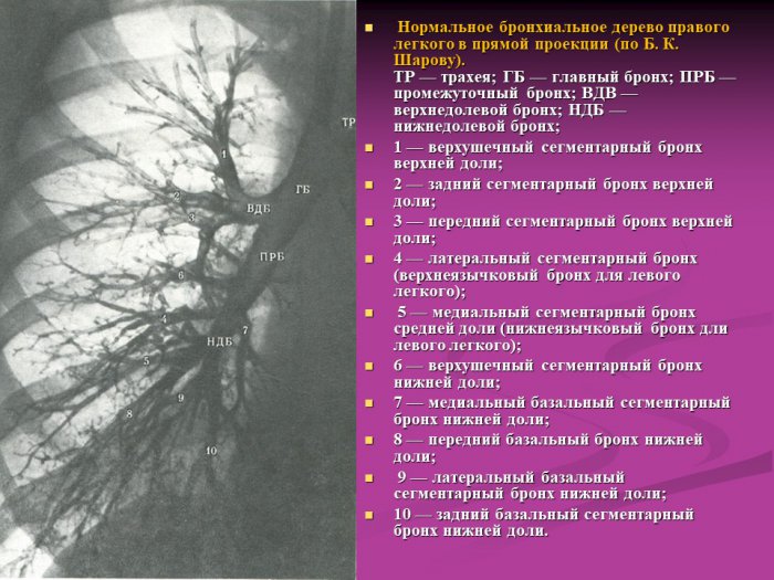Презентация - Строение бронхиального дерева и антомо-топогрофическое строение сегментов легких