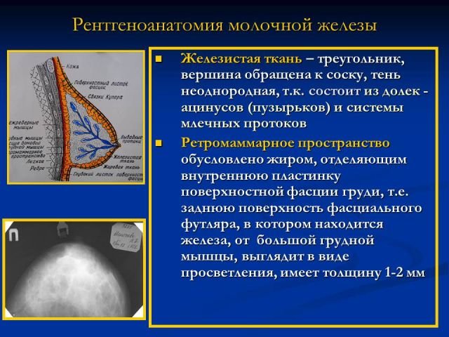 Что означает фиброзное изменение. Рентгеноанатомия молочных желез. Нормальная рентгеноанатомия молочной железы. Рентген анатомия молочных желез. Типы строения молочных желёз.