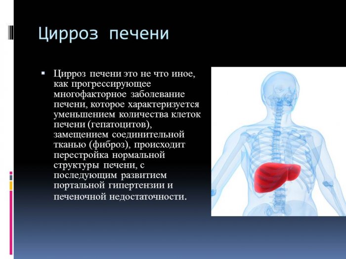 Презентация: Визуальная диагностика при алкогольном циррозе печени