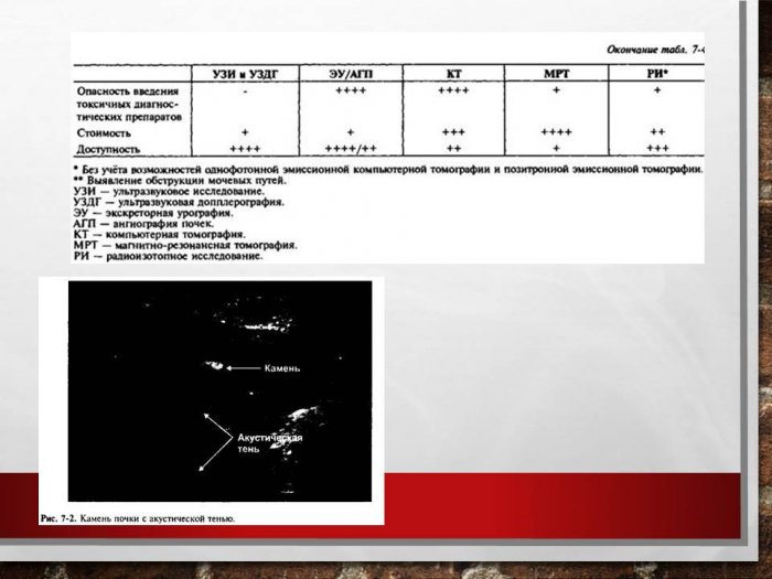 Презентация: Презентация: Лучевые методы исследования в диагностике нефро- и уролитиаза