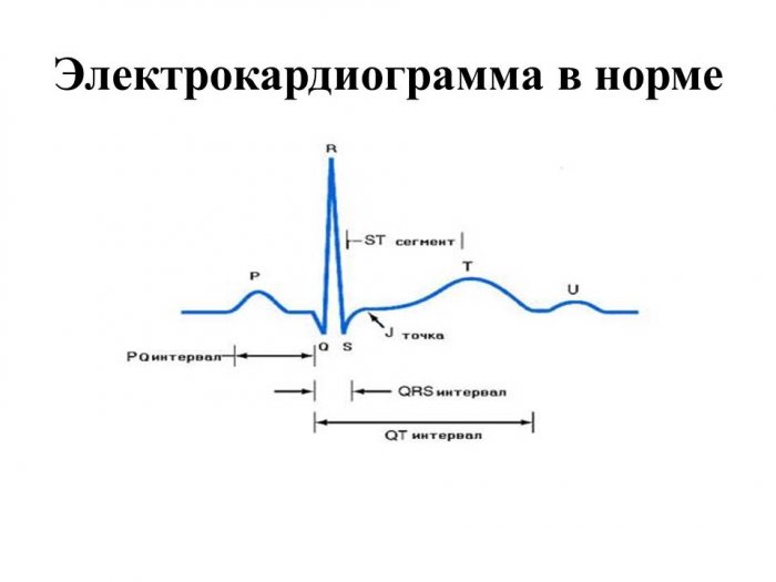 Презентация: Электрокардиограмма в норме