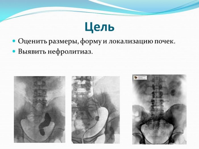 Презентация: Рентгенологическое исследование мочеполовой системы