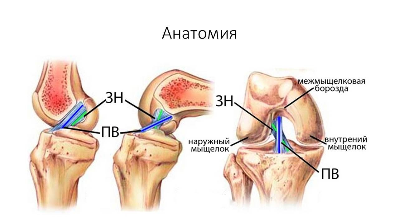 Боль коленной связки
