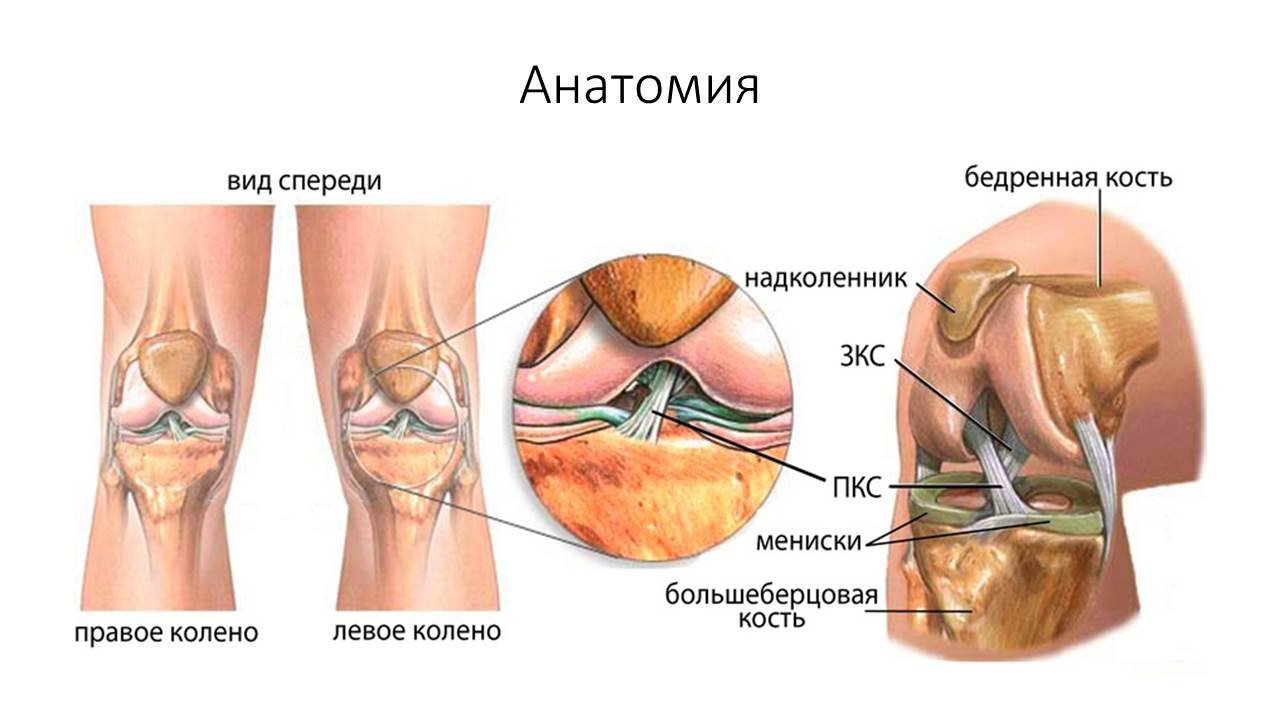 Боли в месте операции. Крестовидные связки коленного сустава анатомия. Крестообразные связки колена анатомия. Коленный сустав строение мениск. Передняя крестообразная связка коленного сустава передняя.