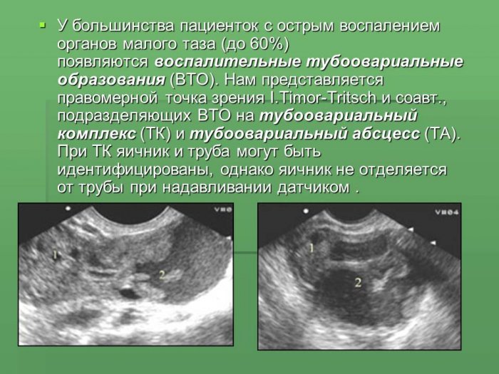 Презентация - Лучевая диагностика репродуктивной системы у женщин