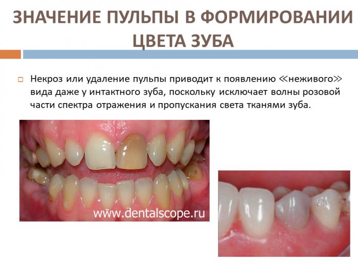 Презентация - Эстетические характеристики зуба
