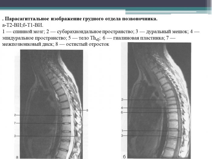 Презентация - Рентгеноанатомия структур головного и спинного мозга