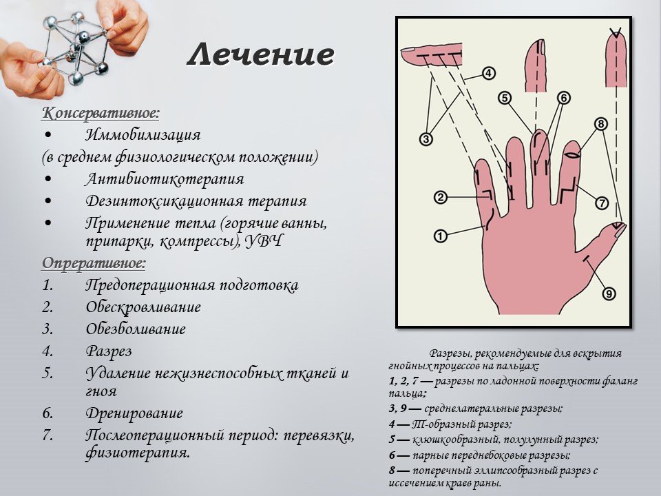 Места пальчика. Флегмоны кисти классификация. Гнойные заболевания кисти флегмона. Флегмона пальцев кисти. При гнойных заболеваниях пальцев и кисти.